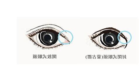 內雙 面相
